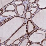 FKBP10 Antibody in Immunohistochemistry (Paraffin) (IHC (P))