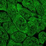 MCTP2 Polyclonal Antibody