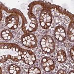 MCTP2 Antibody in Immunohistochemistry (IHC)