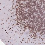 KIAA1644 Antibody in Immunohistochemistry (Paraffin) (IHC (P))