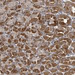 HRASLS Antibody in Immunohistochemistry (Paraffin) (IHC (P))