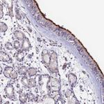 NDUFAF5 Polyclonal Antibody