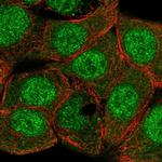 MEKK6 Polyclonal Antibody