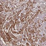 MEKK6 Antibody in Immunohistochemistry (Paraffin) (IHC (P))