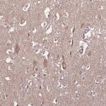KIF16B Antibody in Immunohistochemistry (Paraffin) (IHC (P))