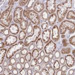 KIF16B Polyclonal Antibody