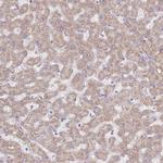 KIF16B Antibody in Immunohistochemistry (Paraffin) (IHC (P))