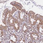 KIF16B Antibody in Immunohistochemistry (Paraffin) (IHC (P))