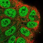 RASSF2 Polyclonal Antibody