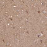 RASSF2 Antibody in Immunohistochemistry (Paraffin) (IHC (P))