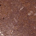 RASSF2 Antibody in Immunohistochemistry (Paraffin) (IHC (P))