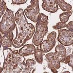 RASSF2 Antibody in Immunohistochemistry (Paraffin) (IHC (P))