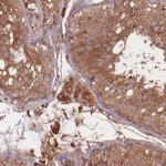 RASSF2 Antibody in Immunohistochemistry (Paraffin) (IHC (P))