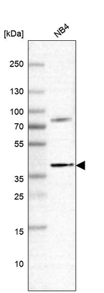 RASSF2 Antibody in Western Blot (WB)