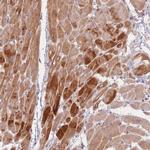 TMOD1 Polyclonal Antibody