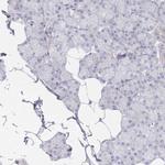 TMOD1 Antibody in Immunohistochemistry (IHC)