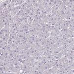 FAM83F Antibody in Immunohistochemistry (Paraffin) (IHC (P))