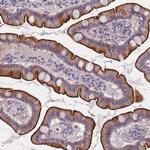 FAM83F Antibody in Immunohistochemistry (Paraffin) (IHC (P))