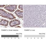 FAM83F Antibody in Immunohistochemistry (IHC)