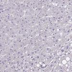 FAM83F Antibody in Immunohistochemistry (IHC)