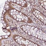 MFHAS1 Antibody in Immunohistochemistry (Paraffin) (IHC (P))