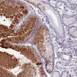 KCNT2 Antibody in Immunohistochemistry (Paraffin) (IHC (P))