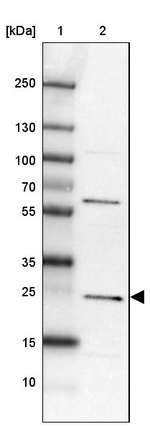 MIF4GD Antibody in Western Blot (WB)