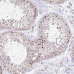 PYHIN1 Polyclonal Antibody