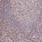 PYHIN1 Antibody in Immunohistochemistry (IHC)