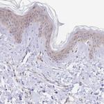 PYHIN1 Antibody in Immunohistochemistry (IHC)