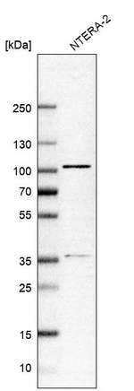 ZNF281 Antibody in Western Blot (WB)