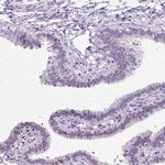 SPC24 Antibody in Immunohistochemistry (Paraffin) (IHC (P))