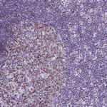 SPC24 Antibody in Immunohistochemistry (Paraffin) (IHC (P))