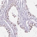 SPC24 Antibody in Immunohistochemistry (Paraffin) (IHC (P))