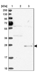 SPC24 Antibody in Western Blot (WB)