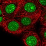 SPC24 Polyclonal Antibody