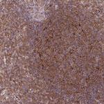 SH3BGRL Antibody in Immunohistochemistry (Paraffin) (IHC (P))
