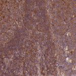 SH3BGRL Antibody in Immunohistochemistry (Paraffin) (IHC (P))