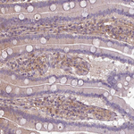 SH3BGRL Antibody in Immunohistochemistry (Paraffin) (IHC (P))