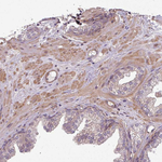 SH3BGRL Polyclonal Antibody