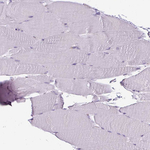 SH3BGRL Antibody in Immunohistochemistry (Paraffin) (IHC (P))