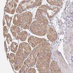 ZW10 Antibody in Immunohistochemistry (Paraffin) (IHC (P))