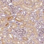 SLC34A1 Antibody in Immunohistochemistry (Paraffin) (IHC (P))