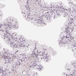 SLC34A1 Antibody in Immunohistochemistry (Paraffin) (IHC (P))
