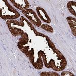 MSMB Polyclonal Antibody