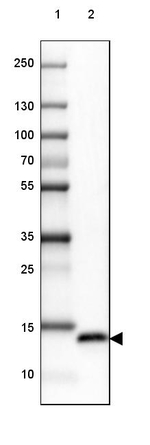 MSMB Antibody in Western Blot (WB)