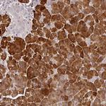 MBD3L3 Polyclonal Antibody