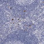DEFA4 Antibody in Immunohistochemistry (IHC)