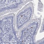 DEFA4 Antibody in Immunohistochemistry (IHC)