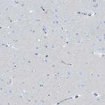 DEFA4 Antibody in Immunohistochemistry (IHC)